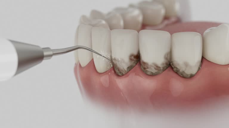 Trusted Teeth Whitening service in Nitro, WV - Dentist Open Now